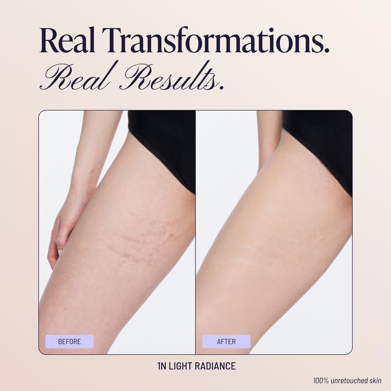 Scar Concealing Nourishing Cream